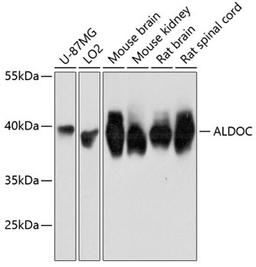 Western blot - ALDOC Antibody (A11618)