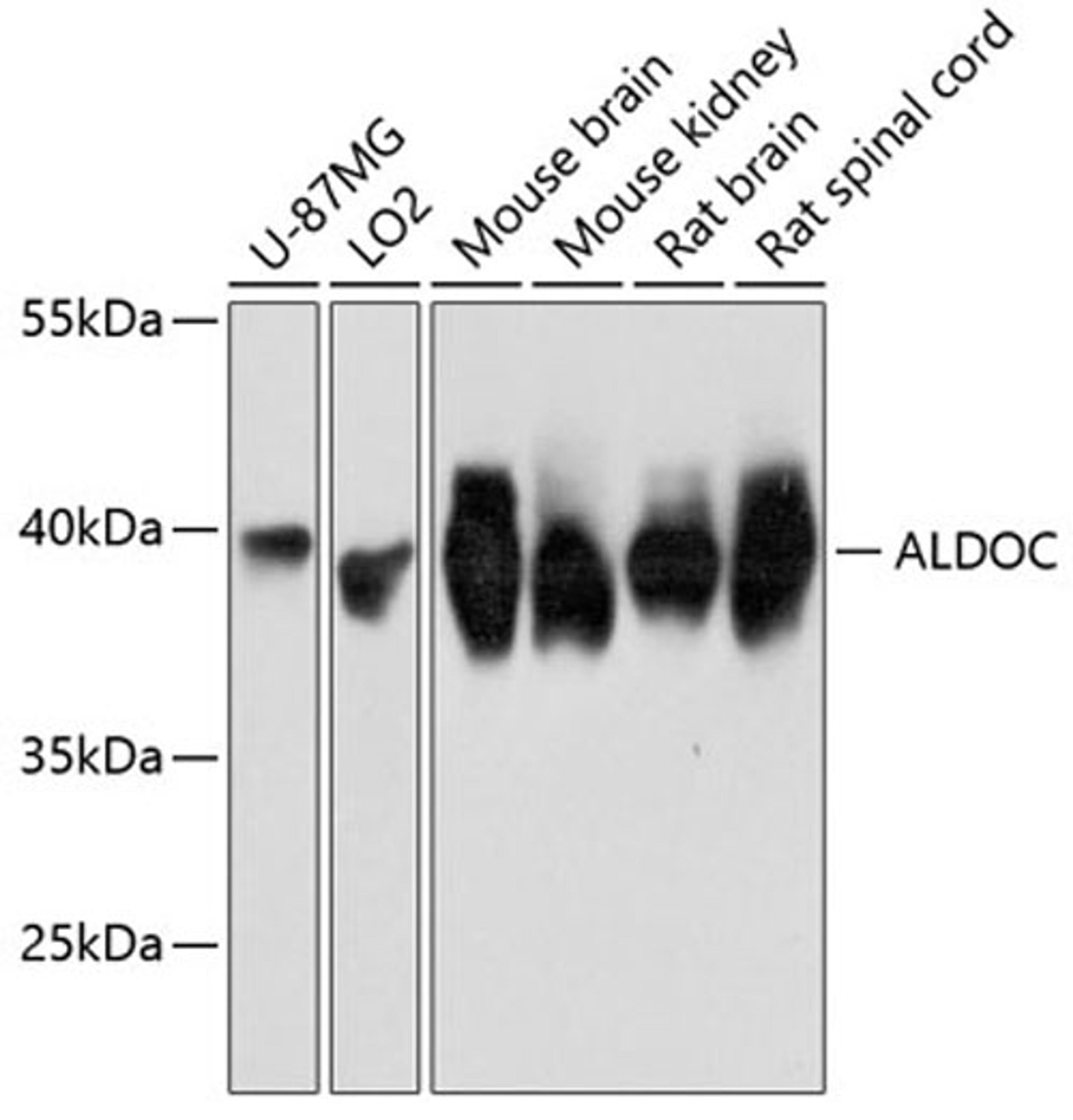 Western blot - ALDOC Antibody (A11618)