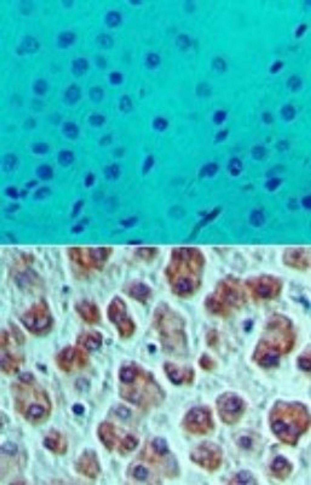 Immunohistochemistry-Paraffin: eIF4A1 Antibody [NBP2-24632] - Analysis of eIF4A1 in formalin-fixed, paraffin-embedded human liver tissue using an isotype control (top) and this antibody (bottom) at 5 ug/ml.