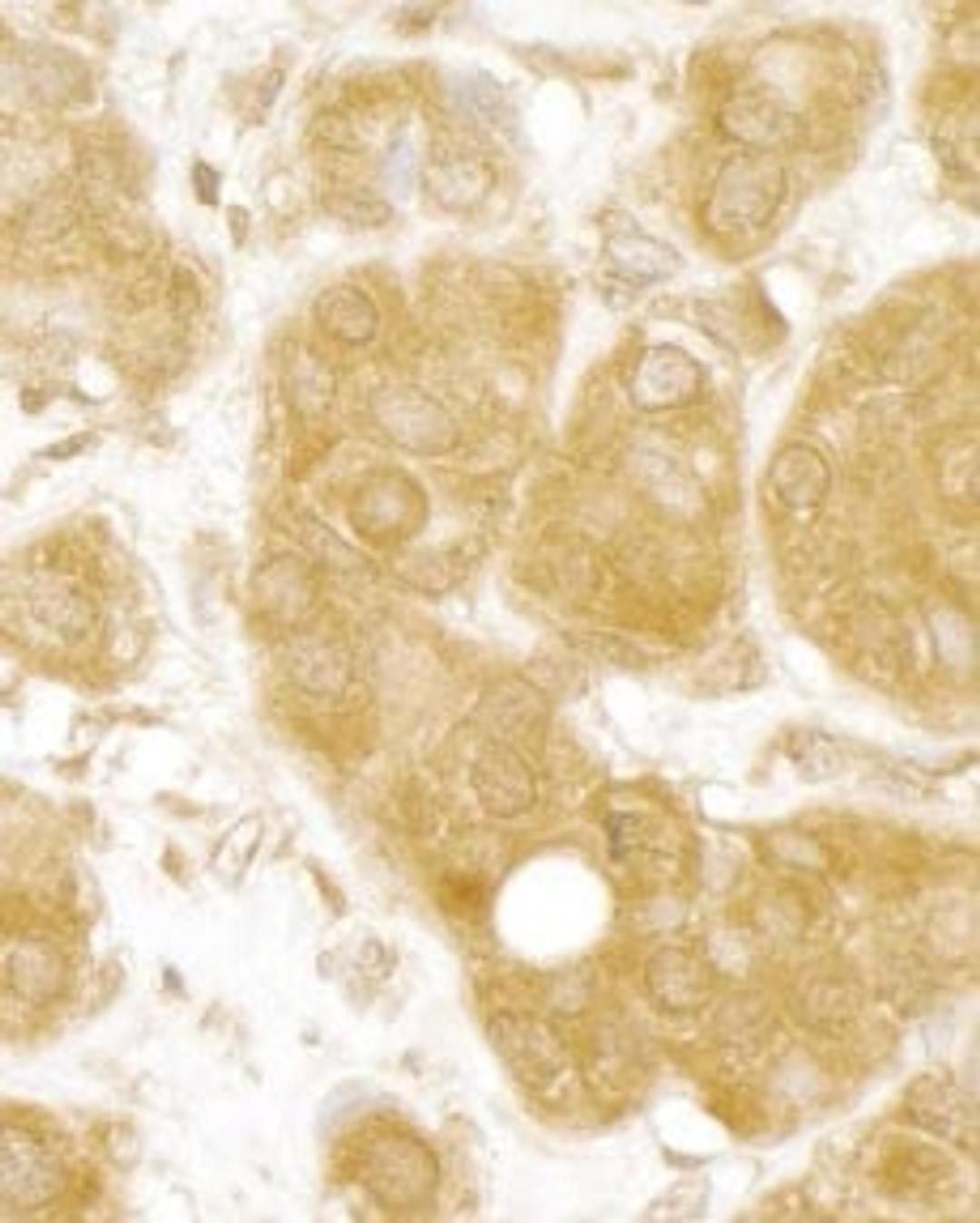 Detection of human MERIT40 by immunohistochemistry.