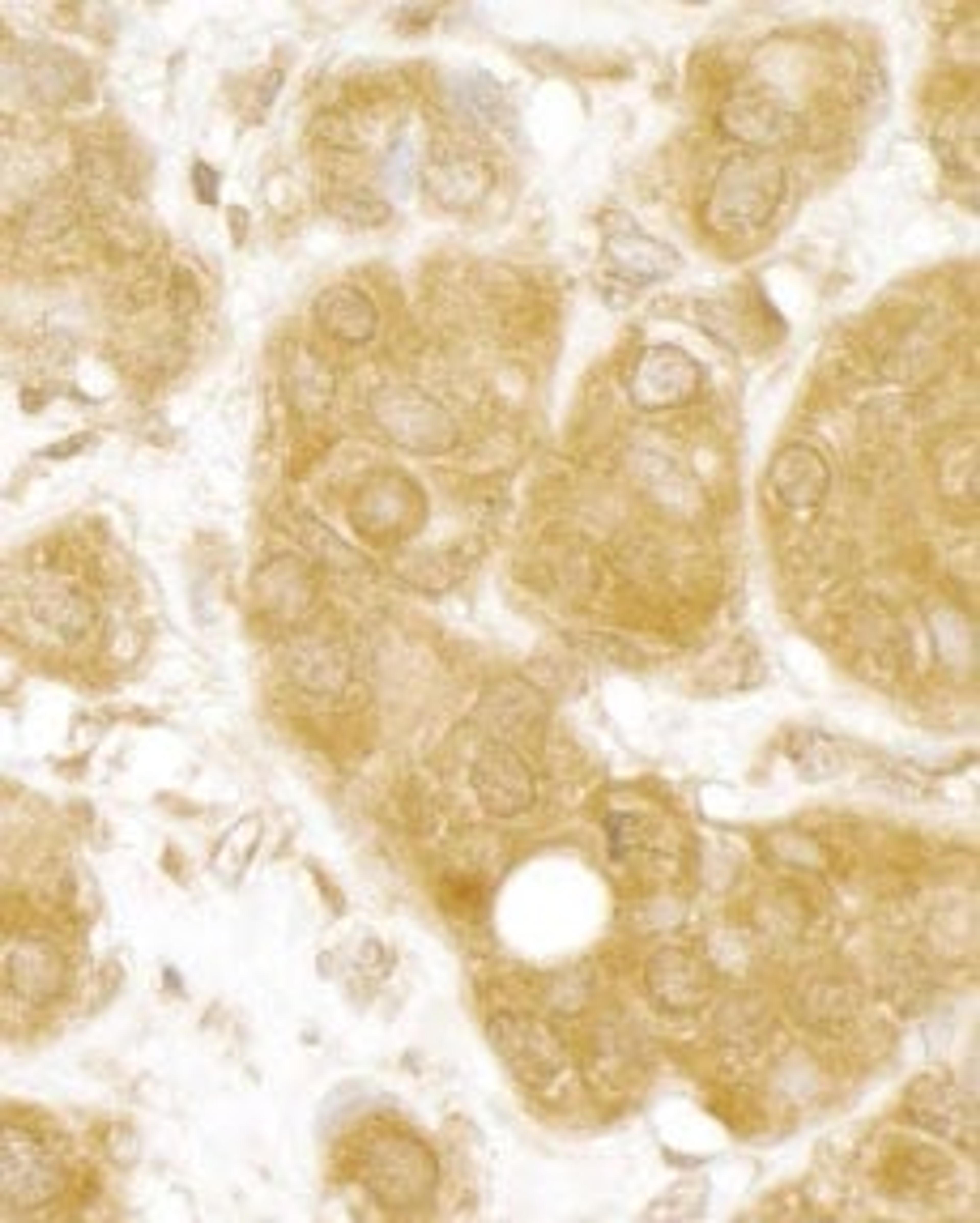 Detection of human MERIT40 by immunohistochemistry.