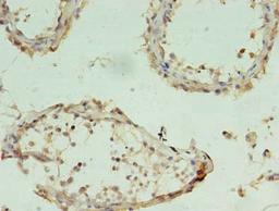Immunohistochemistry of paraffin-embedded human testis tissue using CSB-PA883606LA01HU at dilution of 1:100