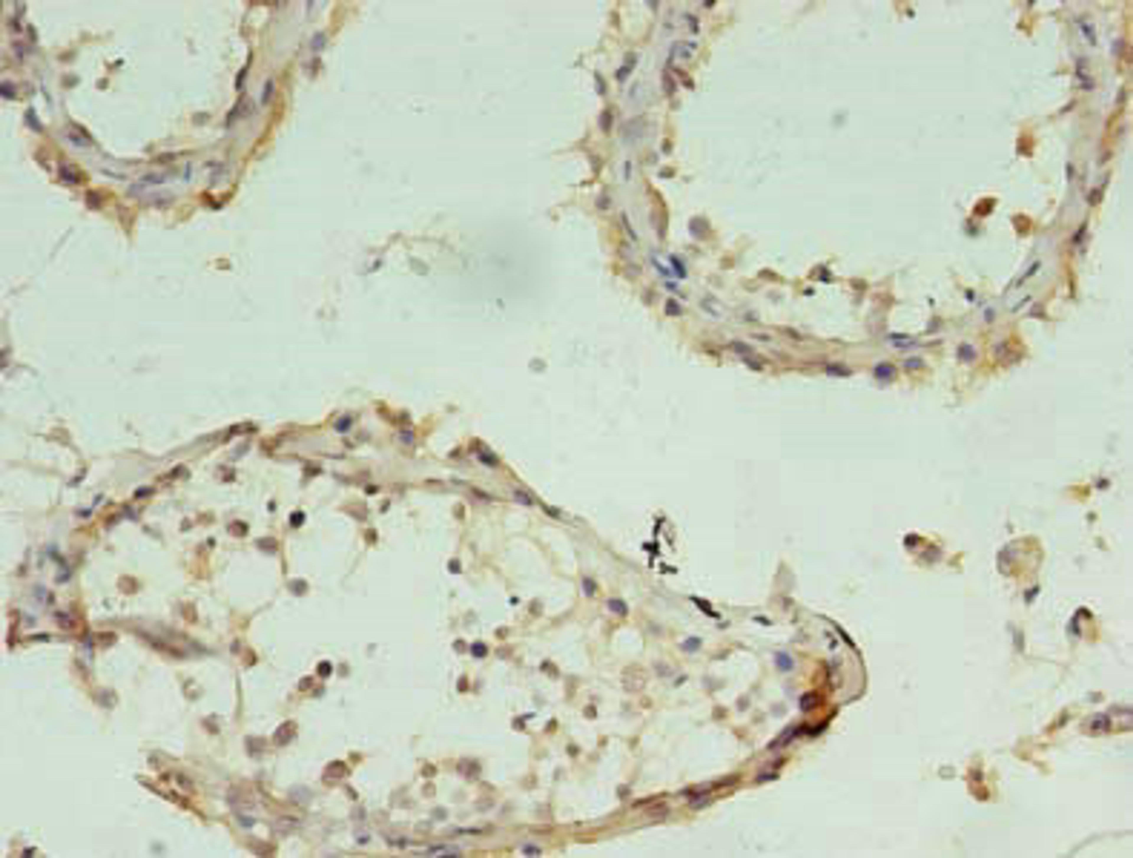 Immunohistochemistry of paraffin-embedded human testis tissue using CSB-PA883606LA01HU at dilution of 1:100