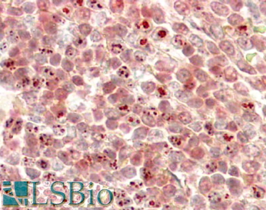 45-890 (3.8ug/ml) staining of paraffin embedded Human Liver. Steamed antigen retrieval with citrate buffer pH 6, HRP-staining.