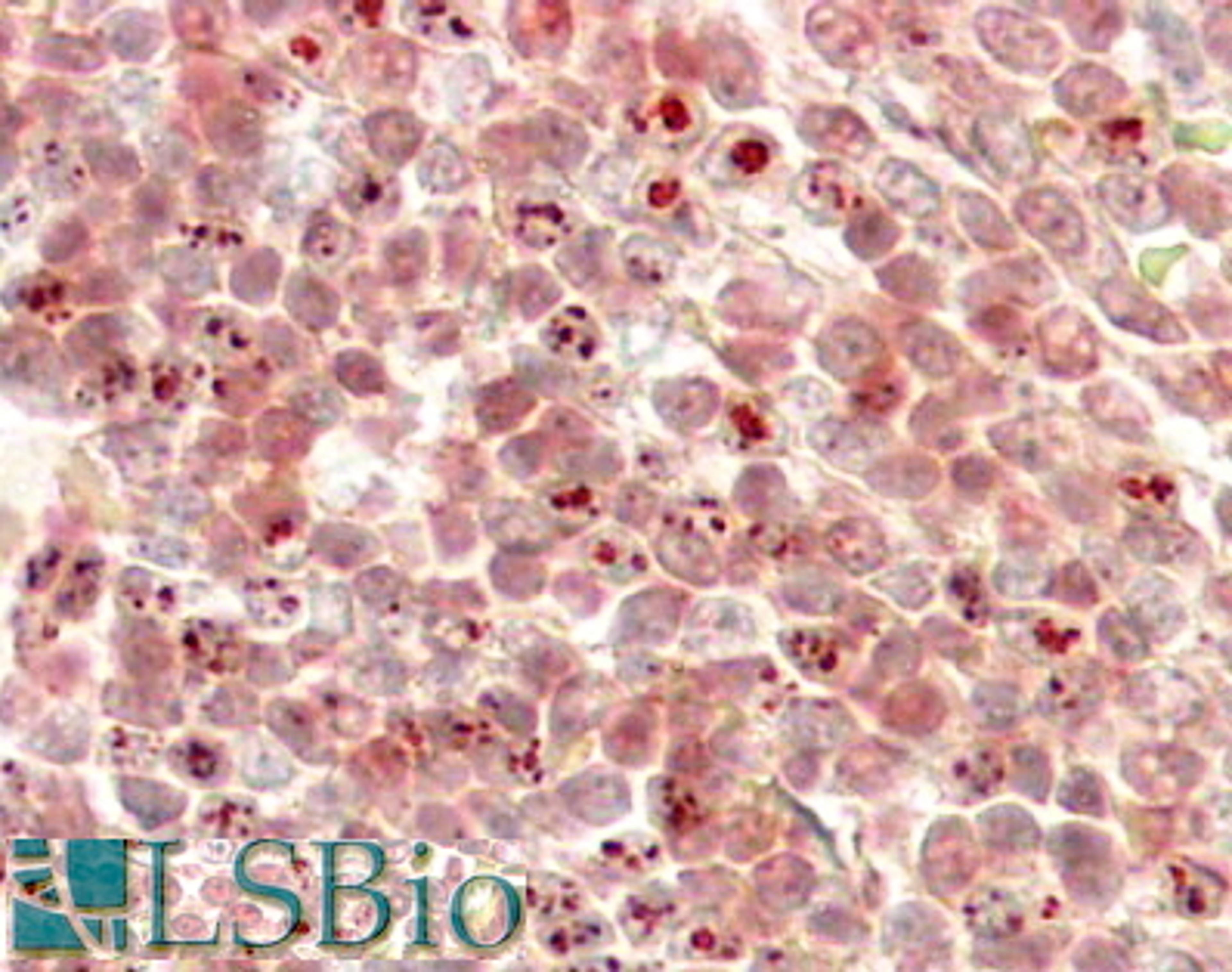 45-890 (3.8ug/ml) staining of paraffin embedded Human Liver. Steamed antigen retrieval with citrate buffer pH 6, HRP-staining.