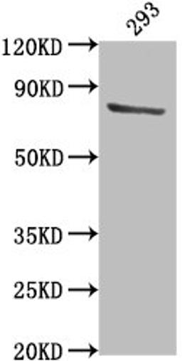 Western Blot. Positive WB detected in: 293 whole cell lysate. All lanes: TBK1 antibody at 1:2000. Secondary. Goat polyclonal to rabbit IgG at 1/50000 dilution. Predicted band size: 84 kDa. Observed band size: 84 kDa. 