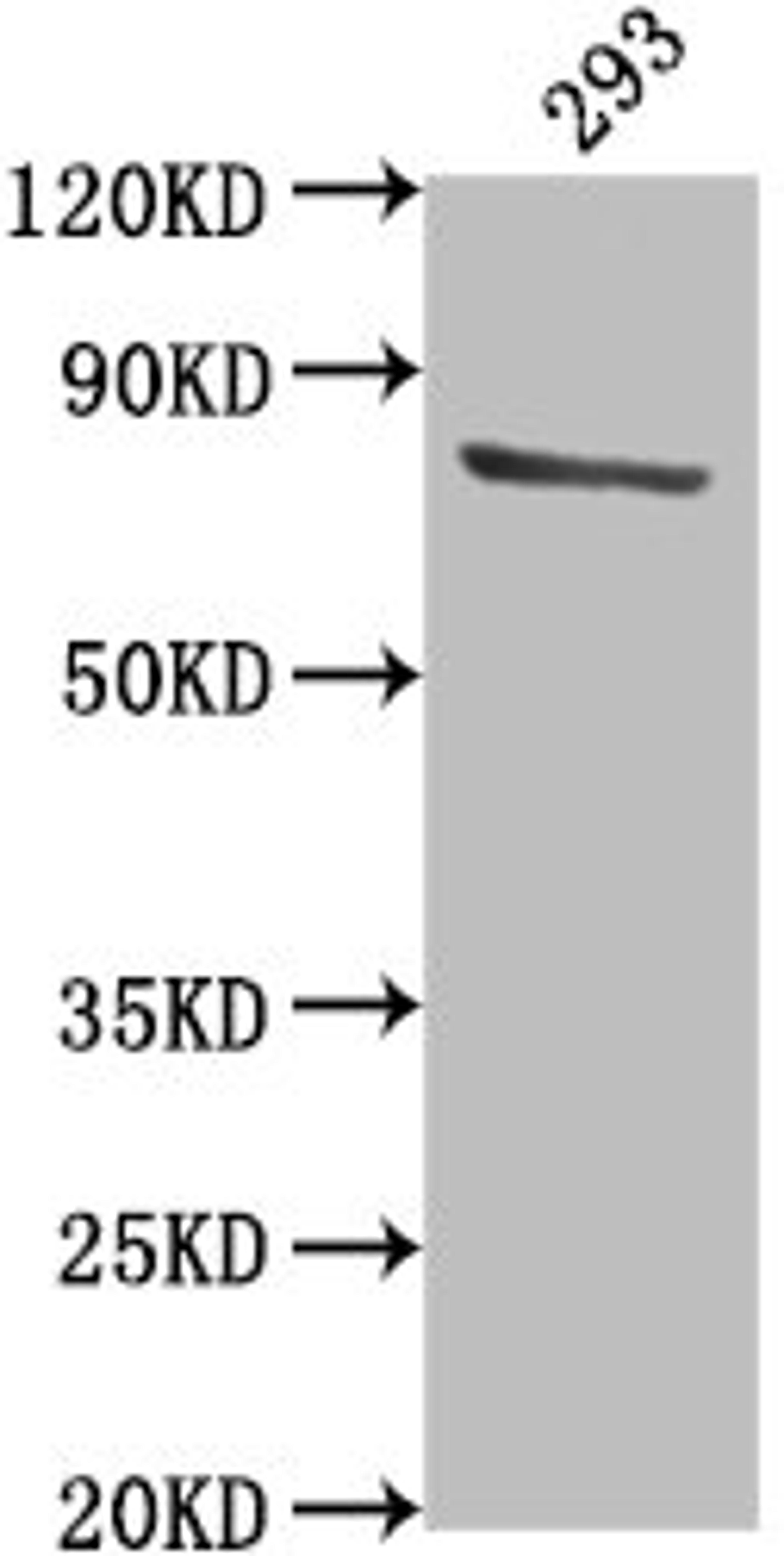 Western Blot. Positive WB detected in: 293 whole cell lysate. All lanes: TBK1 antibody at 1:2000. Secondary. Goat polyclonal to rabbit IgG at 1/50000 dilution. Predicted band size: 84 kDa. Observed band size: 84 kDa. 