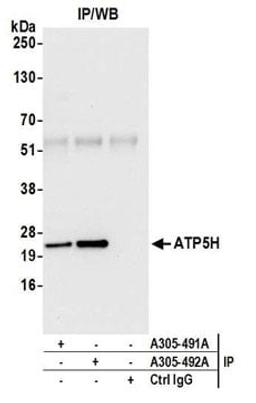 Detection of human ATP5H by western blot of immunoprecipitates.