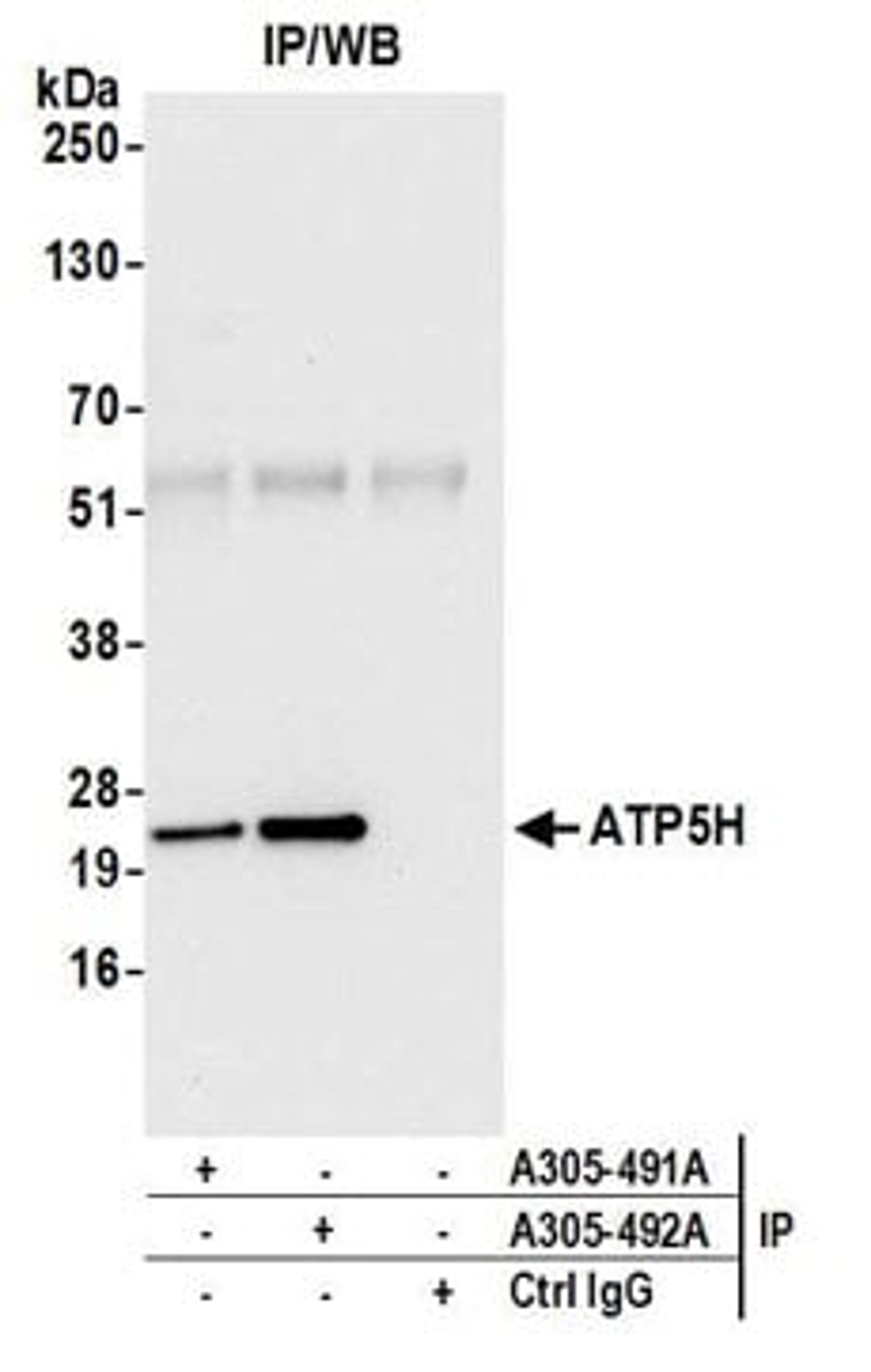 Detection of human ATP5H by western blot of immunoprecipitates.