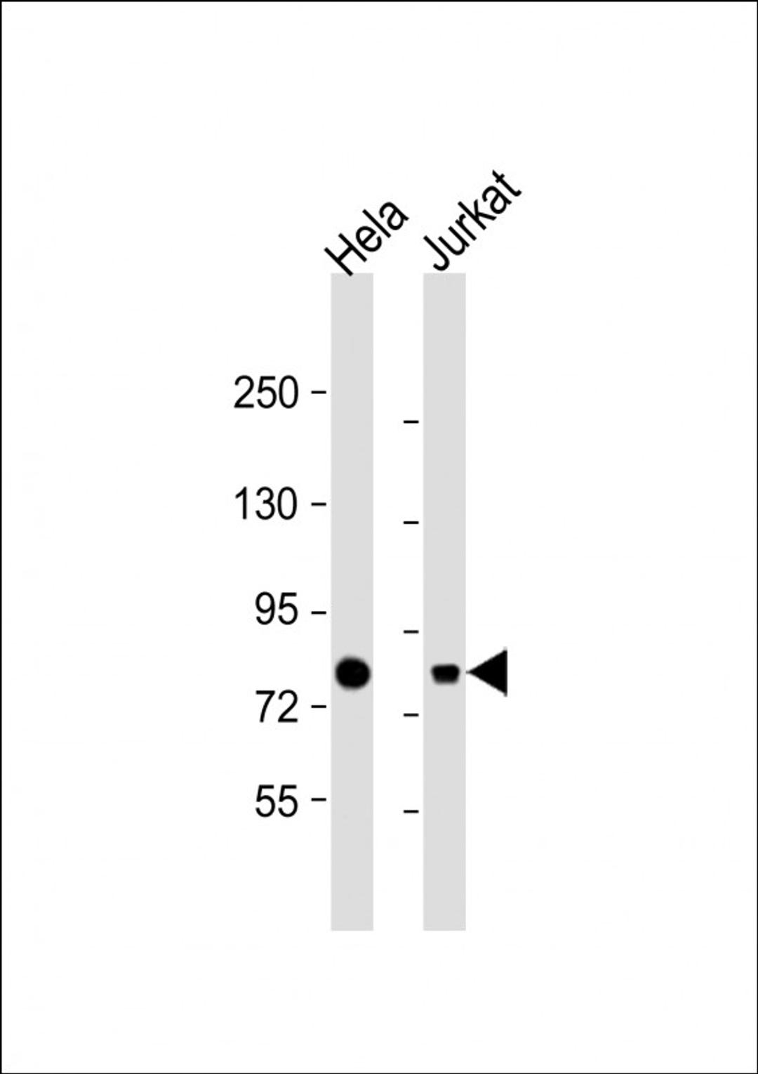 Western Blot at 1:1000 dilution Lane 1: Hela whole cell lysate Lane 2: Jurkat whole cell lysate Lysates/proteins at 20 ug per lane.