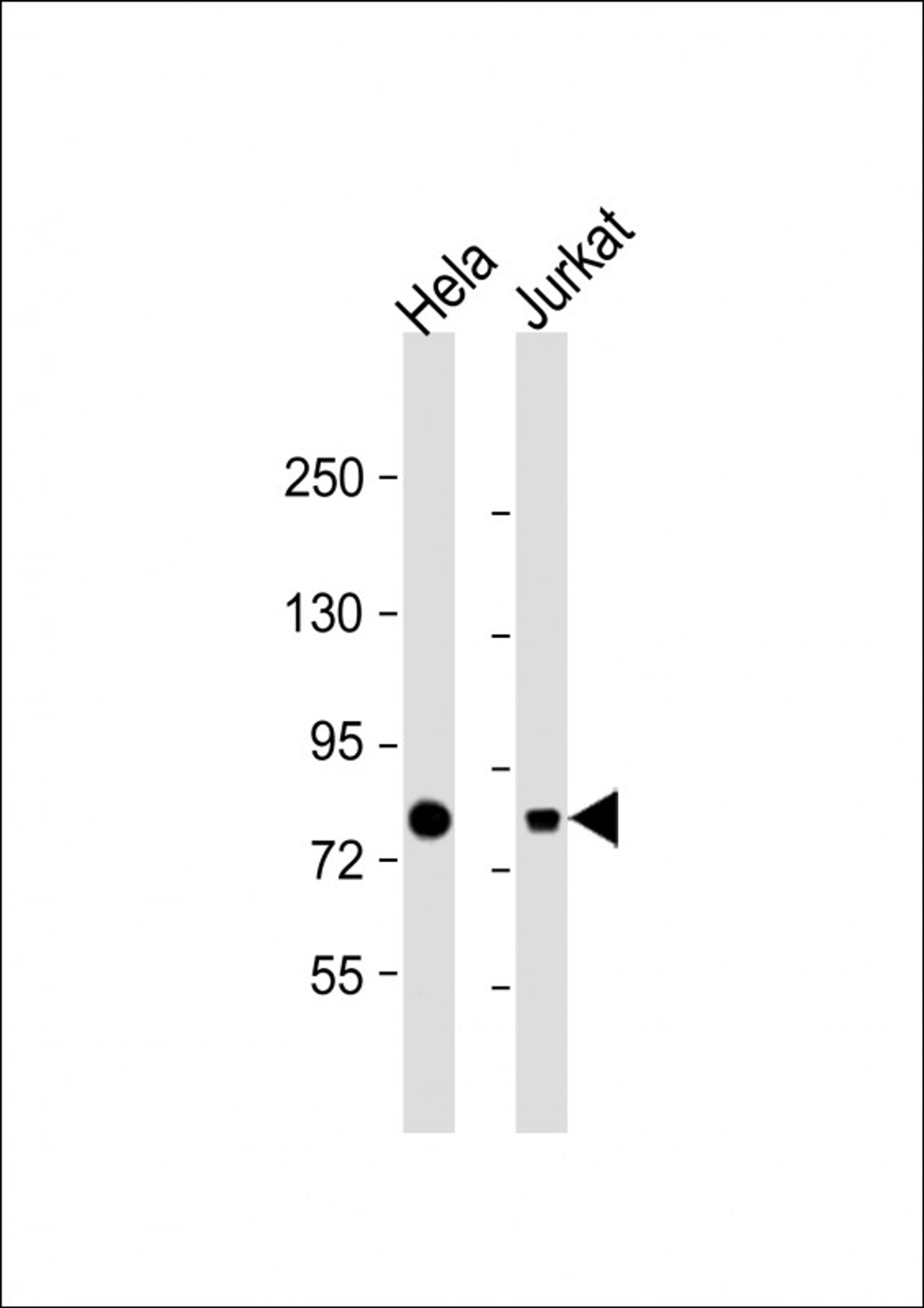 Western Blot at 1:1000 dilution Lane 1: Hela whole cell lysate Lane 2: Jurkat whole cell lysate Lysates/proteins at 20 ug per lane.