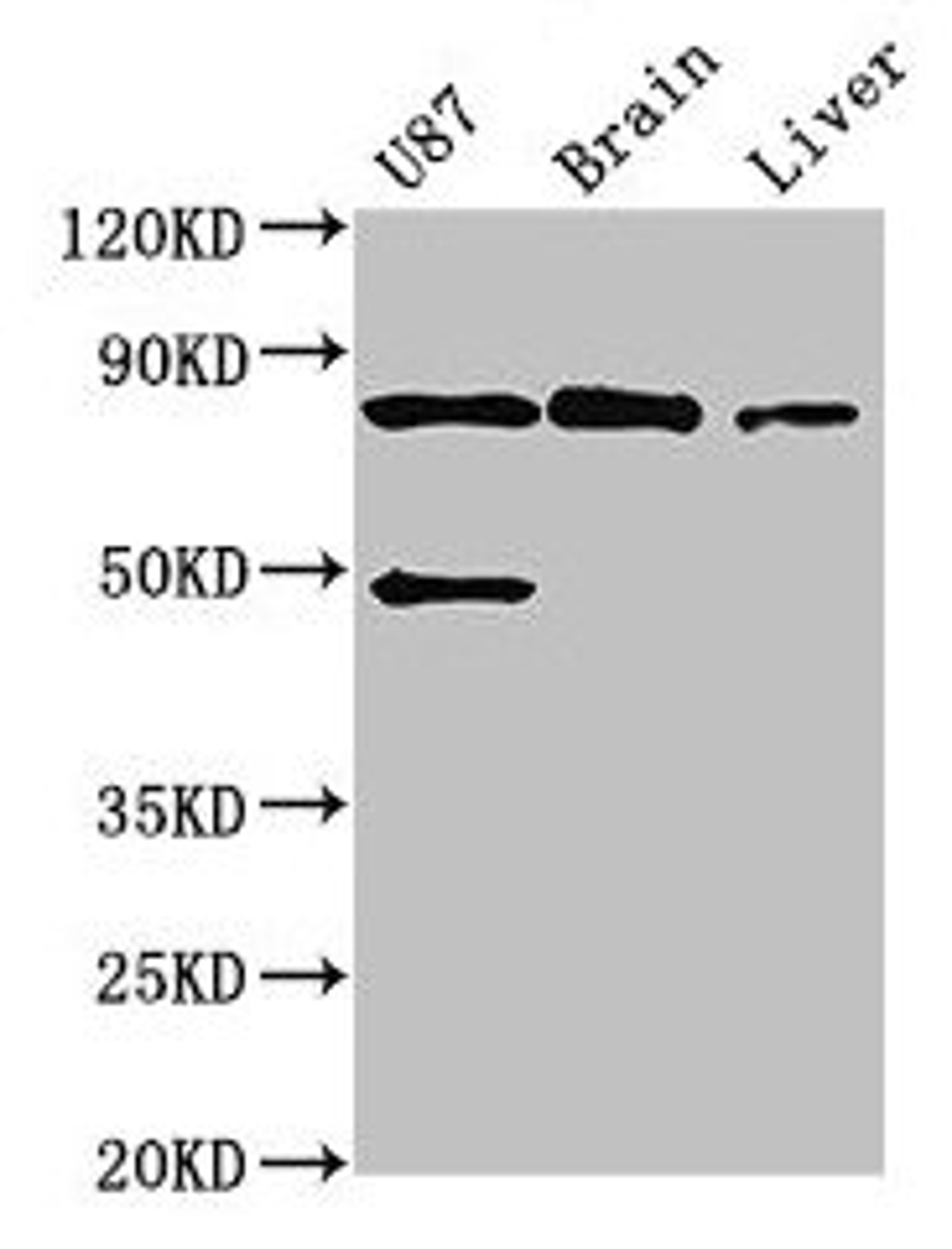 Western Blot. Positive WB detected in: U87 whole cell lysate, Mouse brain tissue, Mouse liver tissue. All lanes: GARS antibody at 3ug/ml. Secondary. Goat polyclonal to rabbit IgG at 1/50000 dilution. Predicted band size: 84 kDa. Observed band size: 84 kDa. 