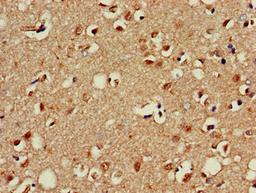 Immunohistochemistry of paraffin-embedded human brain tissue using CSB-PA017298LA01HU at dilution of 1:100