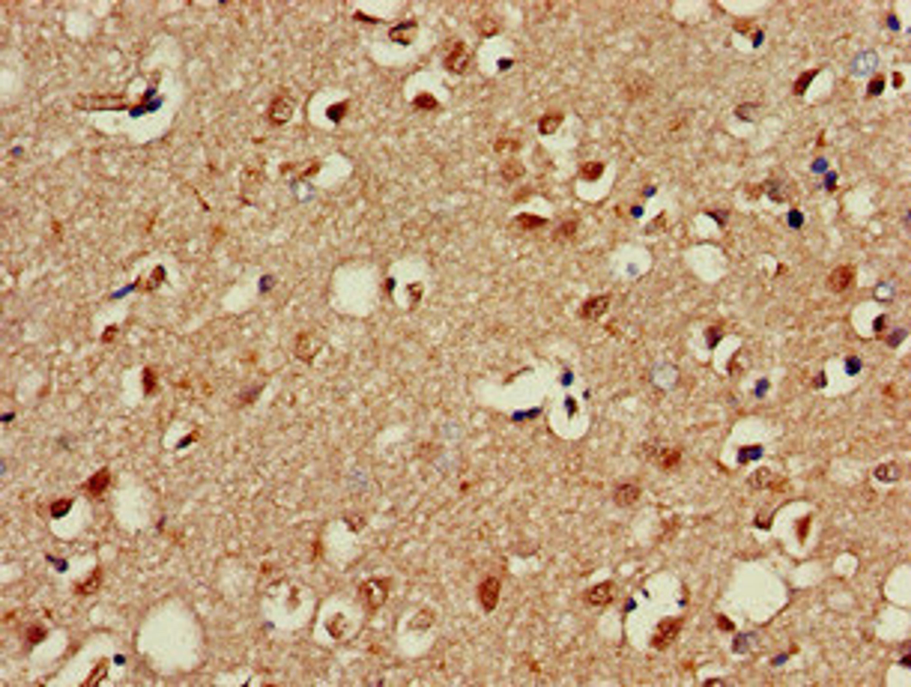 Immunohistochemistry of paraffin-embedded human brain tissue using CSB-PA017298LA01HU at dilution of 1:100