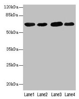 Western blot. All lanes: ESR1 antibody at 7µg/ml. Lane 1: Hela whole cell lysate. Lane 2: MCF-7 whole cell lysate. Lane 3: Rat brain tissue. Lane 4: Colo320 whole cell lysate. Secondary. Goat polyclonal to rabbit IgG at 1/10000 dilution. Predicted band size: 67, 54, 48, 36 kDa. Observed band size: 67 kDa