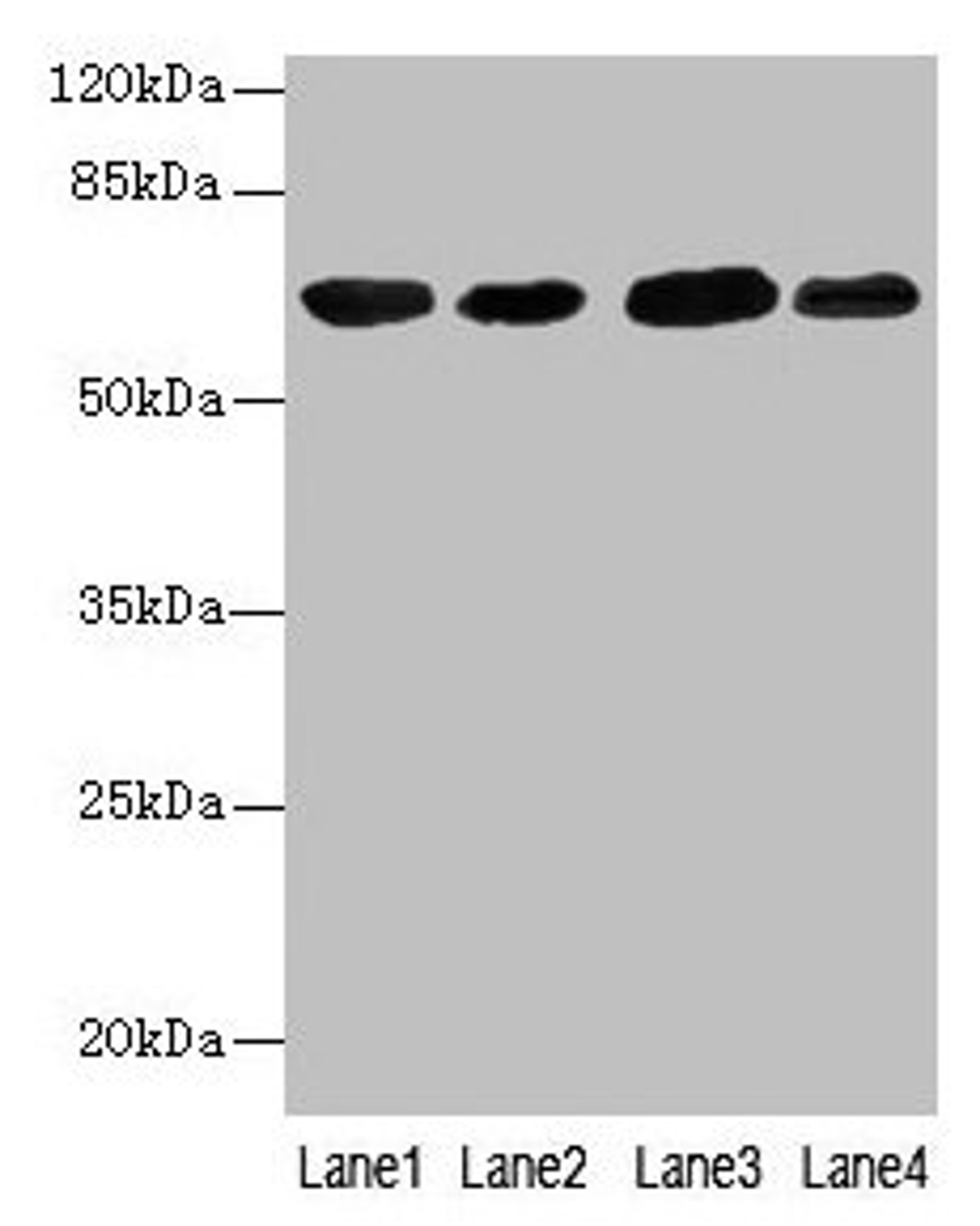 Western blot. All lanes: ESR1 antibody at 7µg/ml. Lane 1: Hela whole cell lysate. Lane 2: MCF-7 whole cell lysate. Lane 3: Rat brain tissue. Lane 4: Colo320 whole cell lysate. Secondary. Goat polyclonal to rabbit IgG at 1/10000 dilution. Predicted band size: 67, 54, 48, 36 kDa. Observed band size: 67 kDa