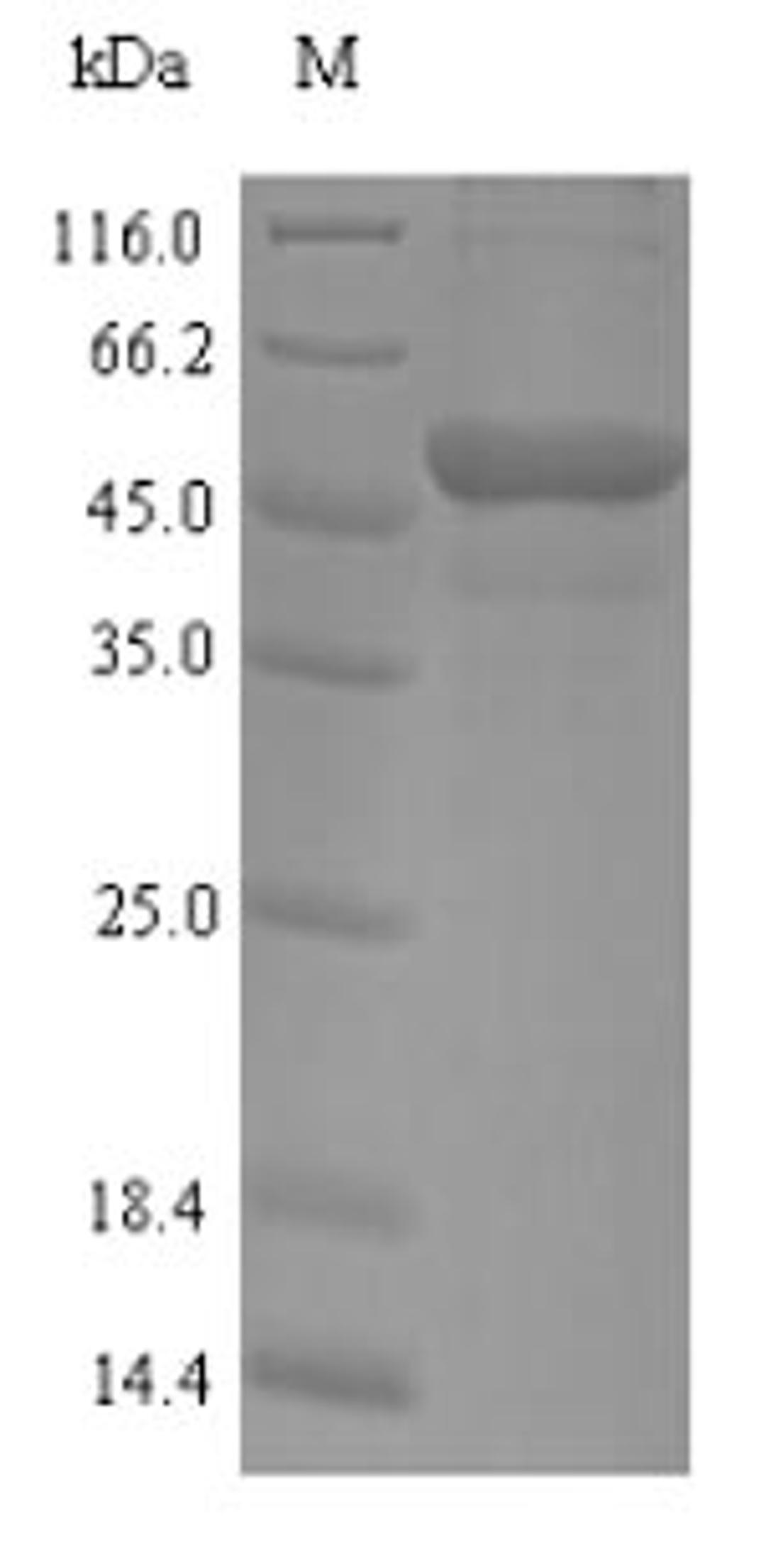 (Tris-Glycine gel) Discontinuous SDS-PAGE (reduced) with 5% enrichment gel and 15% separation gel.