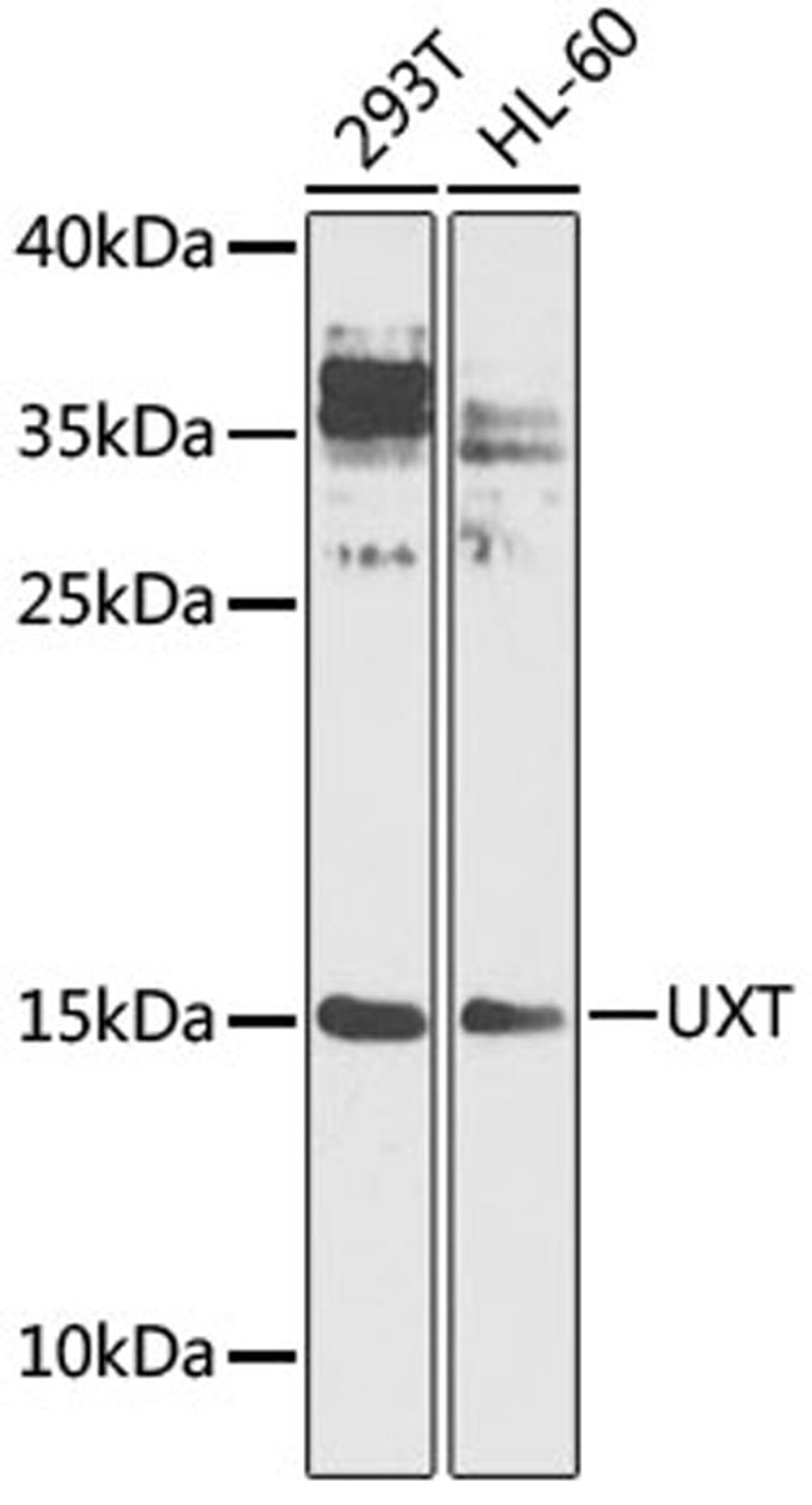 Western blot - UXT antibody (A4217)