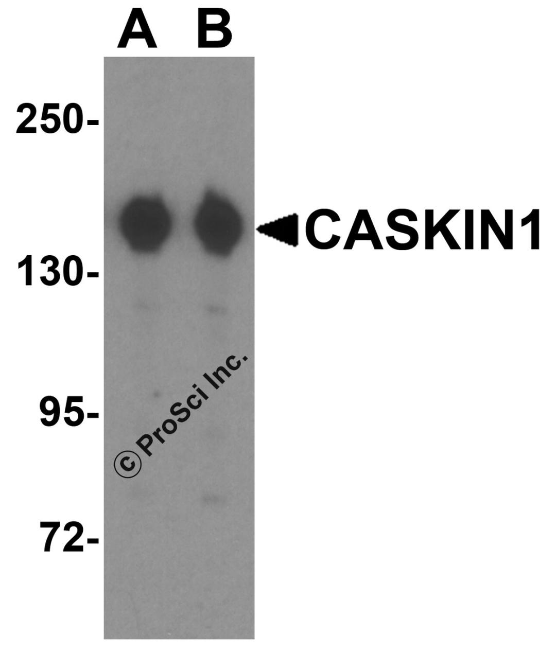 Western blot analysis of CASKIN1 in HeLa cell lysate with CLAUDIN4 antibody at (A) 0.25 and (B) 0.5 &#956;g/mL.