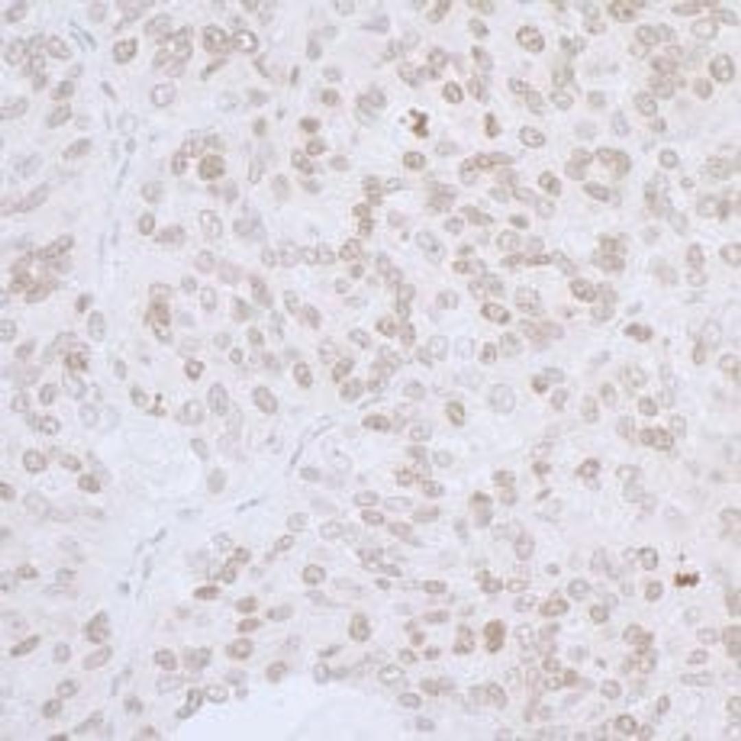 Detection of human LAP2 alpha/TMPO by immunohistochemistry.