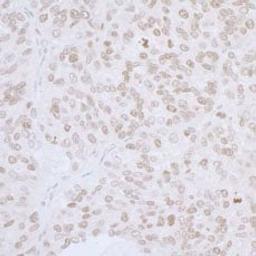 Detection of human LAP2 alpha/TMPO by immunohistochemistry.