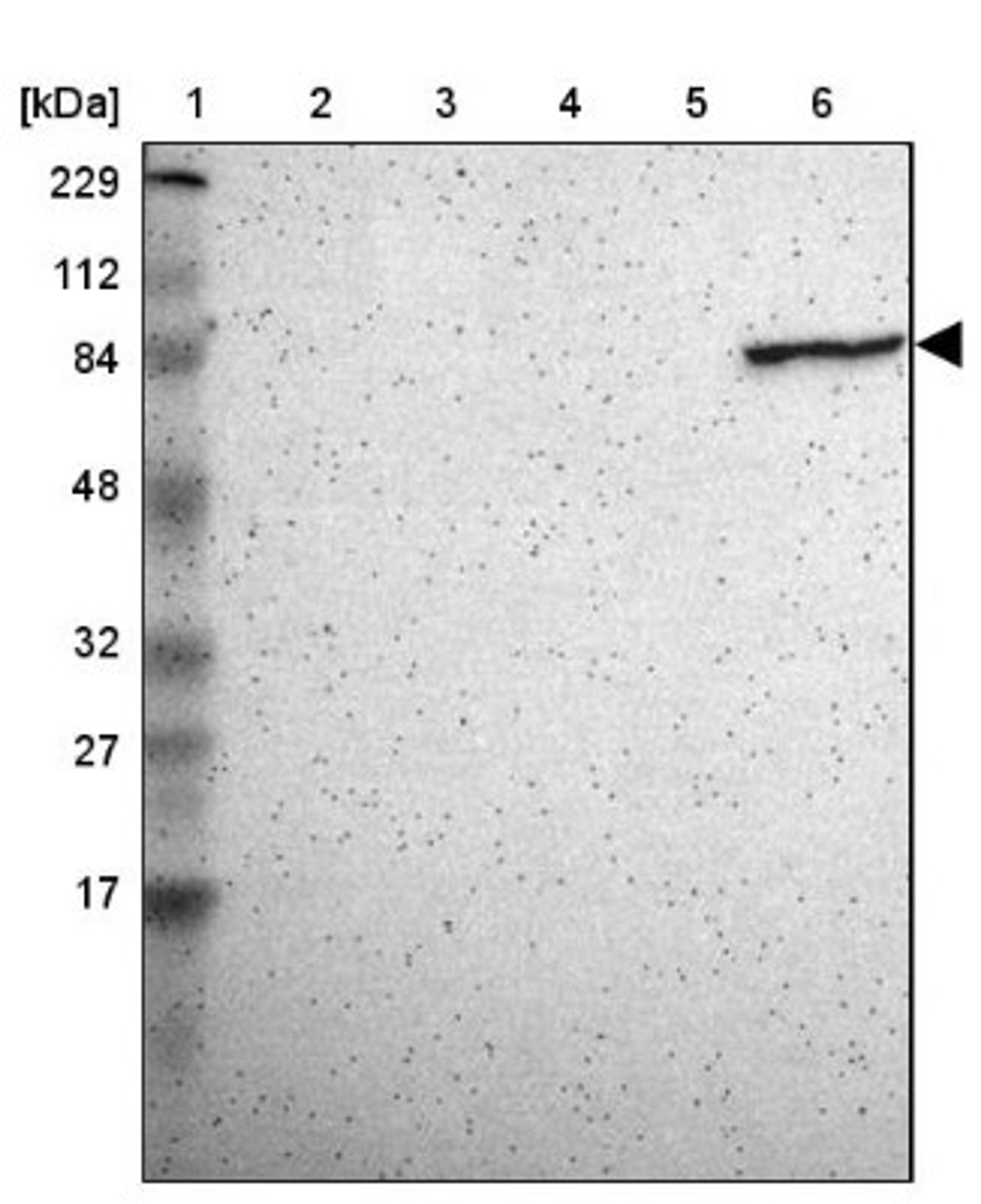 Western Blot: Transglutaminase 3 Antibody [NBP1-86950] - Lane 1: Marker [kDa] 229, 112, 84, 48, 32, 27, 17<br/>Lane 2: Human cell line RT-4<br/>Lane 3: Human cell line U-251MG sp<br/>Lane 4: Human plasma (IgG/HSA depleted)<br/>Lane 5: Human liver tissue<br/>Lane 6: Human tonsil tissue