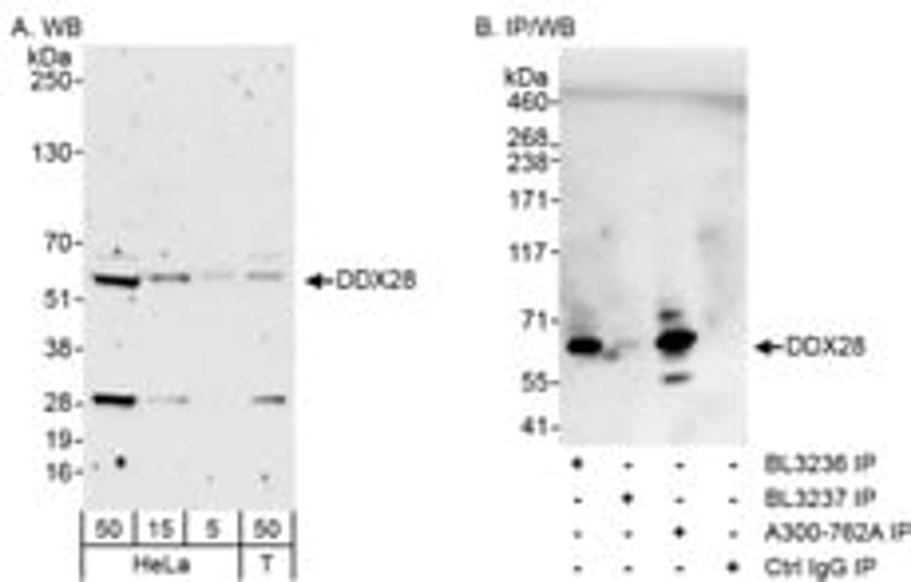 Detection of human DDX28 by western blot and immunoprecipitation.