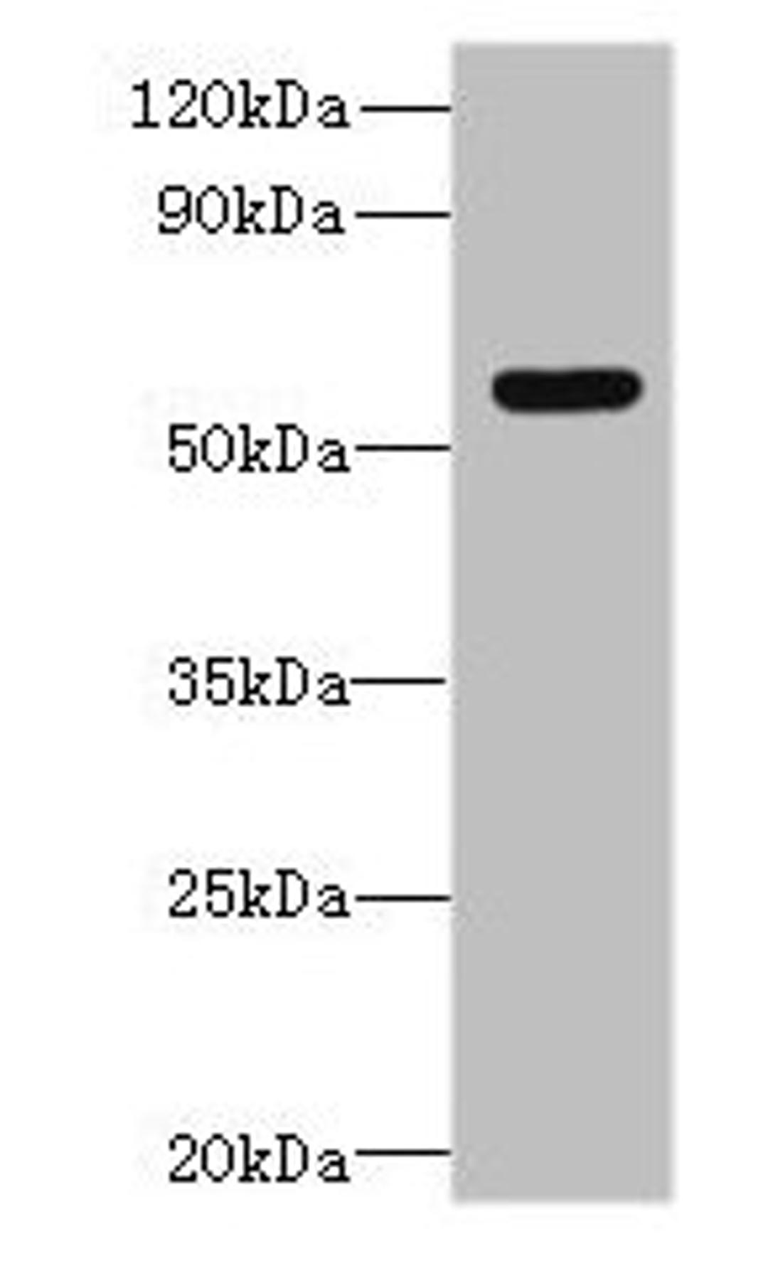 Western blot. All lanes: SLC35F5 antibody at 6µg/ml + Hela whole cell lysate. Secondary. Goat polyclonal to rabbit IgG at 1/10000 dilution. Predicted band size: 59, 28 kDa. Observed band size: 59 kDa