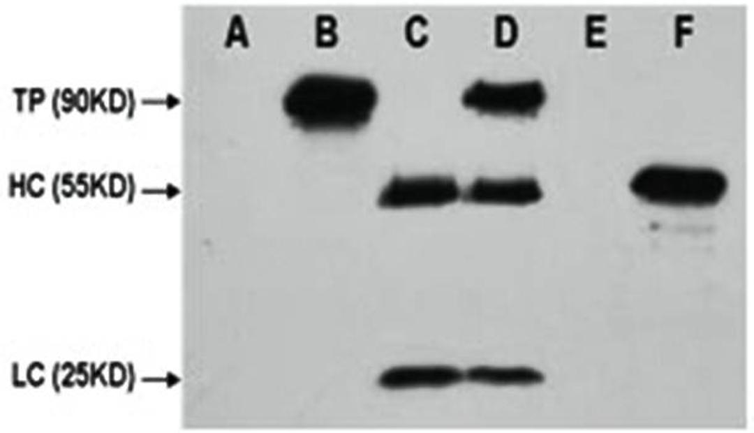 Western blot analysis of HEK 293 cell lysate using CMyc Tag antibody. C-Myc-tag mouse monoclonal antibody A: HEK 293 cell lysate without transfected B: HEK 293 cell lysate transfected with c-myc-tag protein C: IP (PBS + anti- c-myc mAb 4? overnight) D: IP