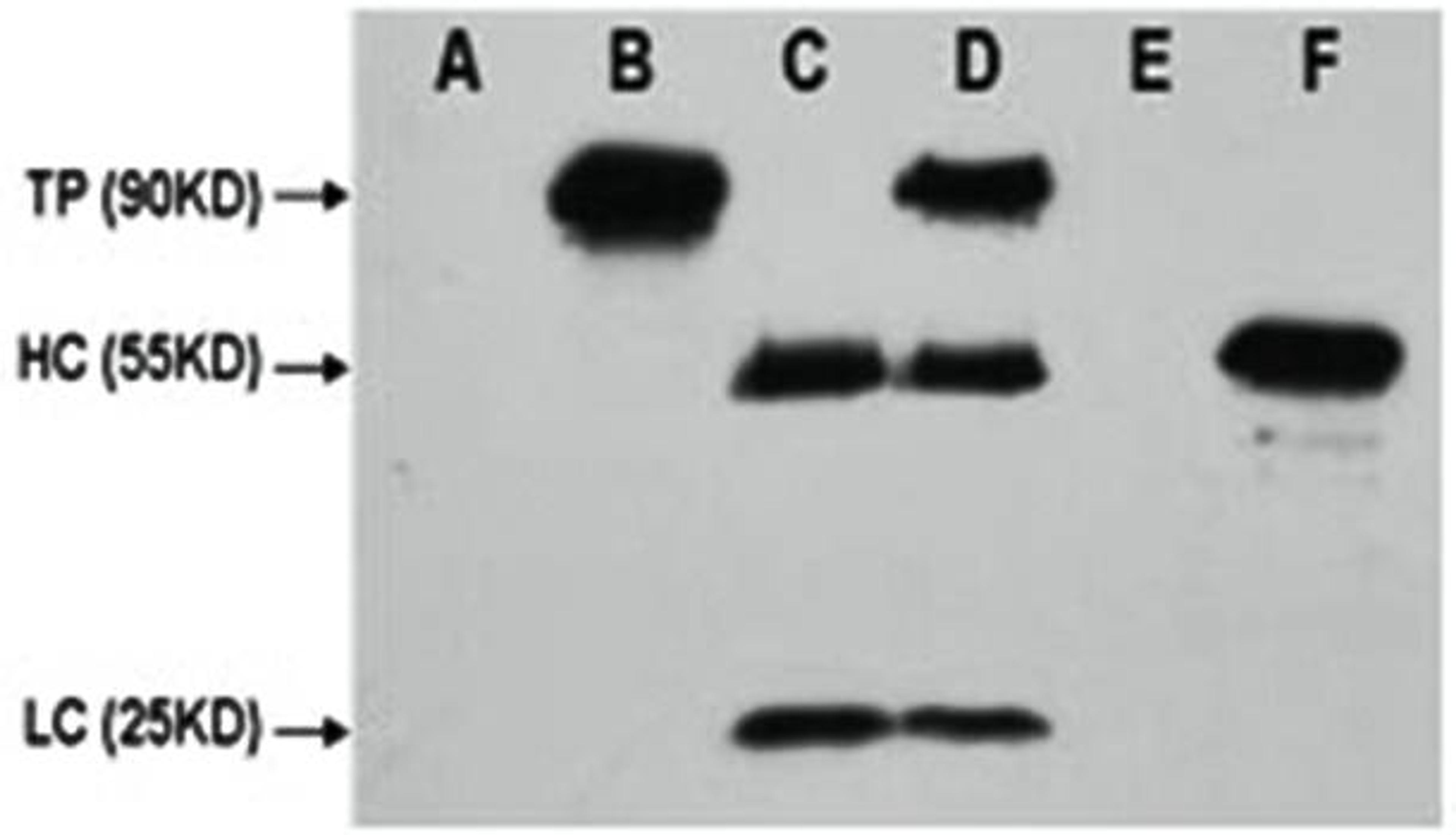 Western blot analysis of HEK 293 cell lysate using CMyc Tag antibody. C-Myc-tag mouse monoclonal antibody A: HEK 293 cell lysate without transfected B: HEK 293 cell lysate transfected with c-myc-tag protein C: IP (PBS + anti- c-myc mAb 4? overnight) D: IP