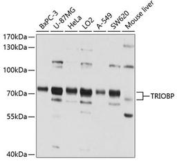 Western blot - TRIOBP antibody (A4485)