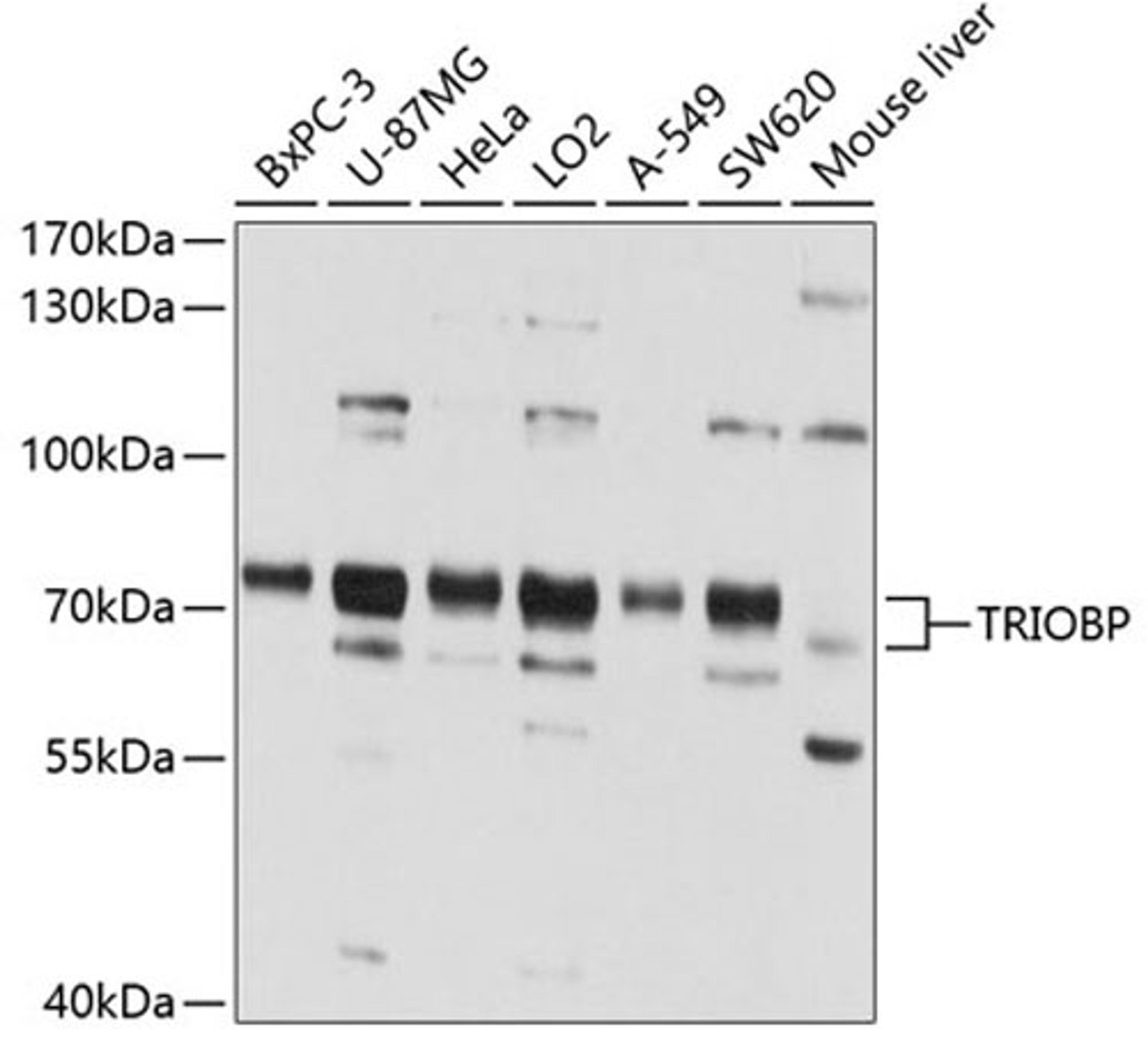 Western blot - TRIOBP antibody (A4485)