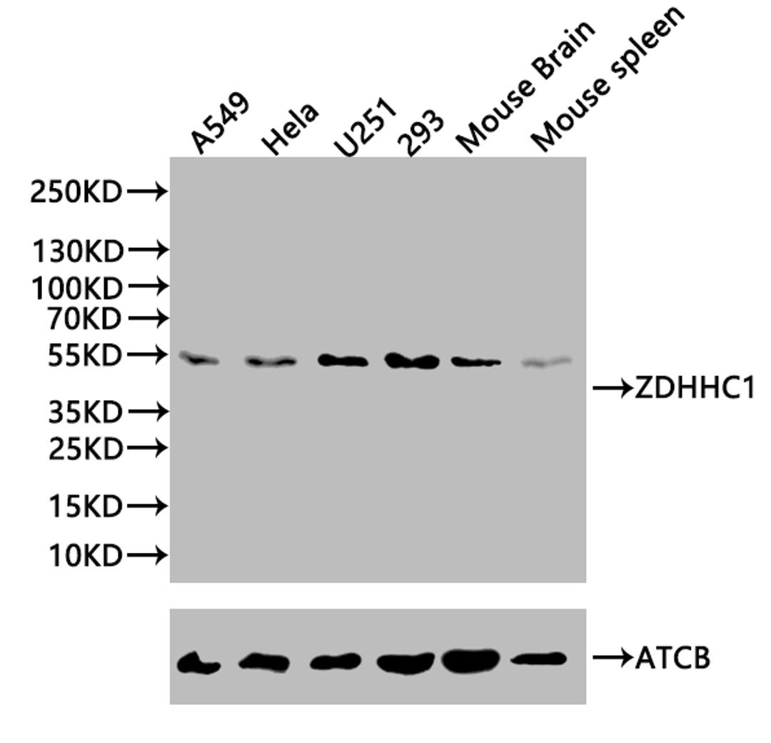 Western Blot. Positive WB detected in: Mouse spleen tissue. All lanes: C16orf1 antibody at 2.6ug/ml. Secondary. Goat polyclonal to rabbit IgG at 1/50000 dilution. Predicted band size: 55 kDa. Observed band size: 55 kDa.