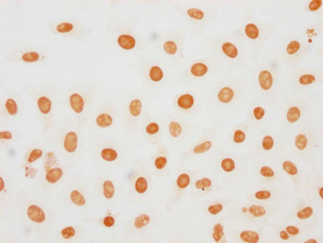 Immunocytochemistry analysis of CSB-PA010377OA188phHU diluted at 1:20 and staining in Hela cells(treated with 50nM Calyculin A for 30min) performed on a Leica BondTM system. The cells were fixed in 4% formaldehyde, permeabilized using 0.2% Triton X-100 and blocked with 10% normal goat serum 30min at RT. Then primary antibody (1% BSA) was incubated at 4°C overnight. The primary is detected by a biotinylated secondary antibody and visualized using an HRP conjugated SP system.
