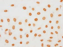 Immunocytochemistry analysis of CSB-PA010377OA188phHU diluted at 1:20 and staining in Hela cells(treated with 50nM Calyculin A for 30min) performed on a Leica BondTM system. The cells were fixed in 4% formaldehyde, permeabilized using 0.2% Triton X-100 and blocked with 10% normal goat serum 30min at RT. Then primary antibody (1% BSA) was incubated at 4°C overnight. The primary is detected by a biotinylated secondary antibody and visualized using an HRP conjugated SP system.