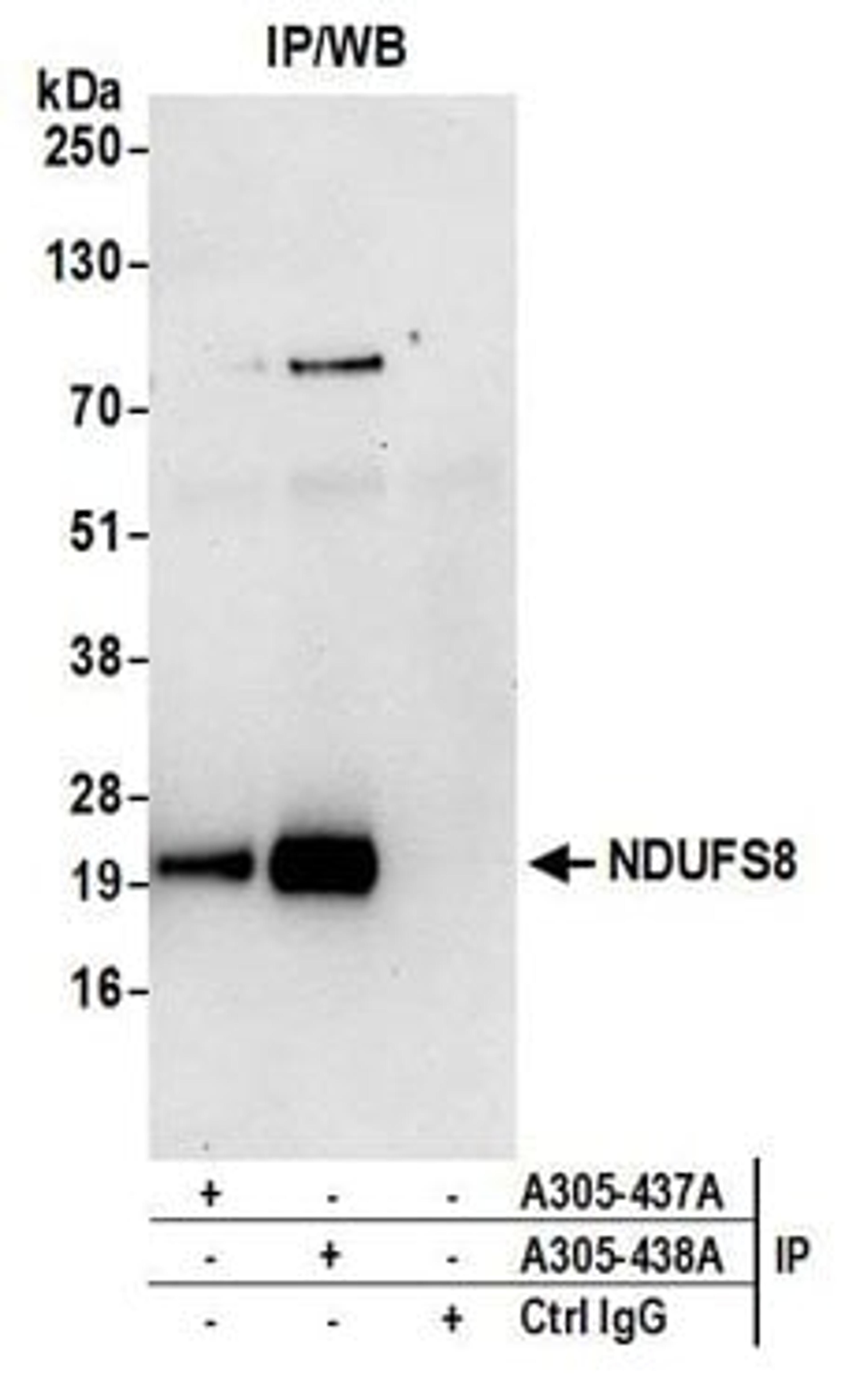 Detection of human NDUFS8 by western blot of Immunoprecipitates.