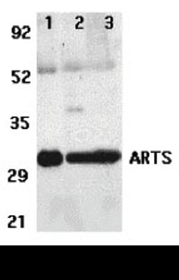 Western blot analysis of ARTS expression in human lung (lane 1), spleen (lane 2), and kidney (lane 3) tissue lysates with ARTS antibody at 2 &#956;g /ml. 