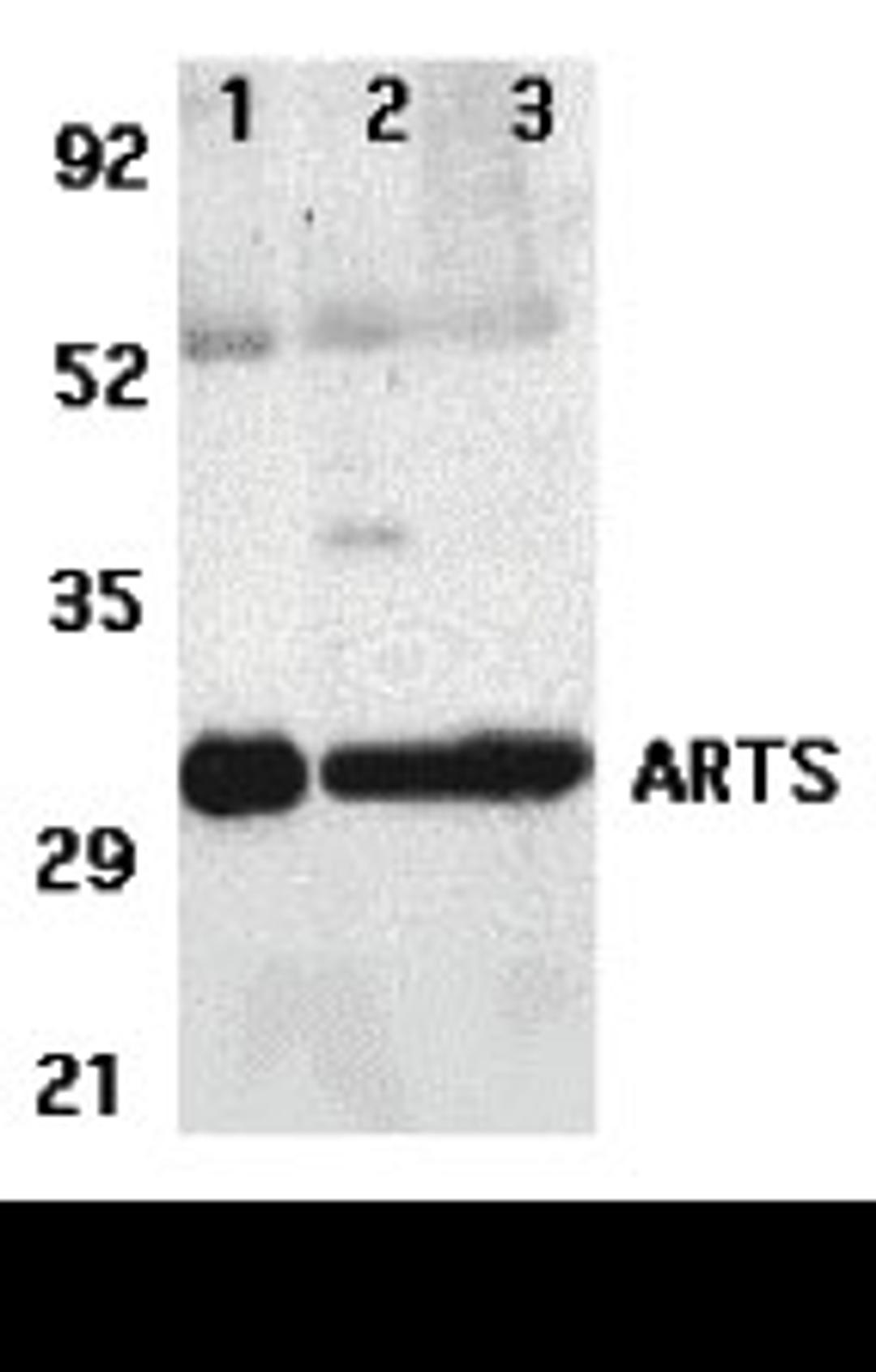 Western blot analysis of ARTS expression in human lung (lane 1), spleen (lane 2), and kidney (lane 3) tissue lysates with ARTS antibody at 2 μg /ml.