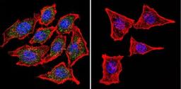 Immunocytochemistry/Immunofluorescence: CHRND Antibody (88B) [NB120-2804] - Analysis of Nicotinic Acetylcholine Receptor using Anti-Nicotinic Acetylcholine Receptor Monoclonal Antibody (88B) shows staining in Hela Cells. Nicotinic Acetylcholine Receptor staining (green), F-Actin staining with Phalloidin (red) and nuclei with DAPI (blue) is shown. Cells were grown on chamber slides and fixed with formaldehyde prior to staining. Cells were probed without (control) or with or an antibody recognizing Nicotinic Acetylcholine Receptor at a dilution of 1:100 over night at 4C, washed with PBS and incubated with a DyLight-488 conjugated.