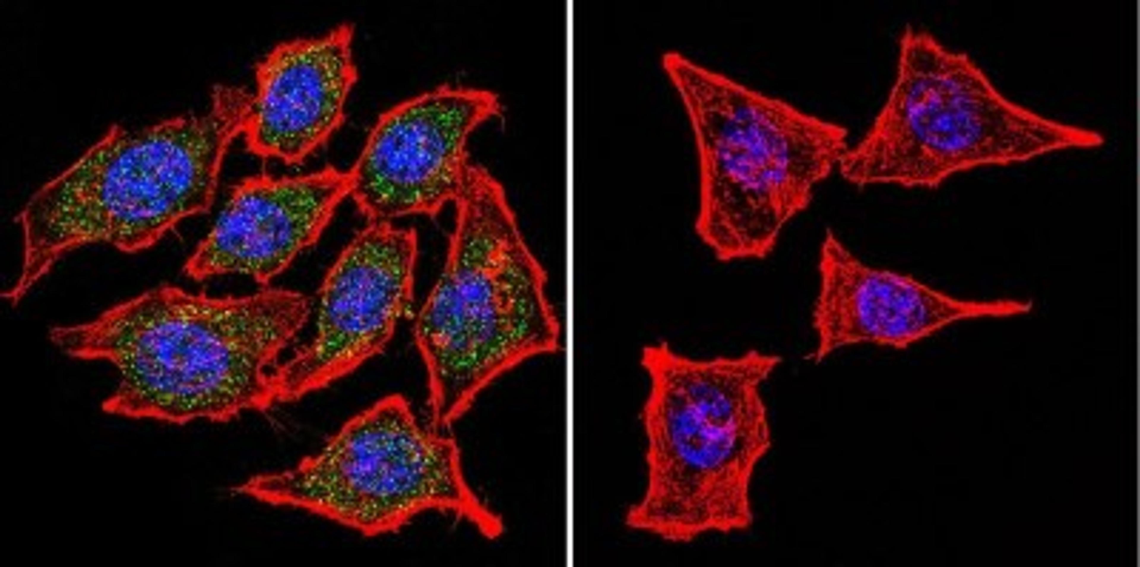 Immunocytochemistry/Immunofluorescence: CHRND Antibody (88B) [NB120-2804] - Analysis of Nicotinic Acetylcholine Receptor using Anti-Nicotinic Acetylcholine Receptor Monoclonal Antibody (88B) shows staining in Hela Cells. Nicotinic Acetylcholine Receptor staining (green), F-Actin staining with Phalloidin (red) and nuclei with DAPI (blue) is shown. Cells were grown on chamber slides and fixed with formaldehyde prior to staining. Cells were probed without (control) or with or an antibody recognizing Nicotinic Acetylcholine Receptor at a dilution of 1:100 over night at 4C, washed with PBS and incubated with a DyLight-488 conjugated.