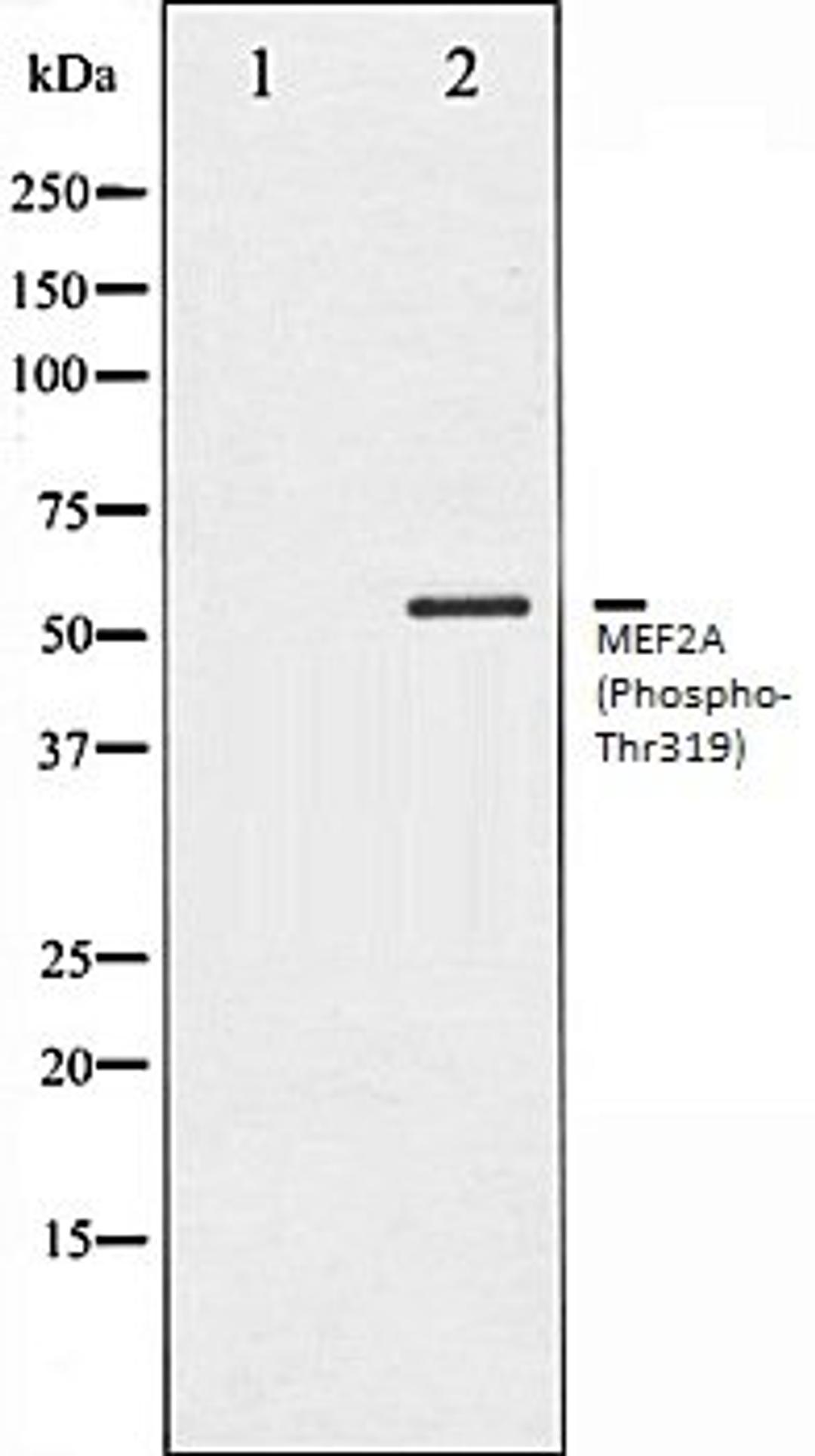 Western blot analysis of K562 whole cell lysates using MEF2A (Phospho-Thr319) antibody, The lane on the left is treated with the antigen-specific peptide.