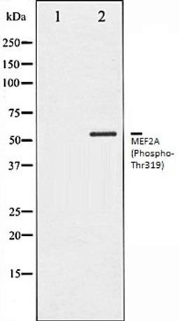 Western blot analysis of K562 whole cell lysates using MEF2A (Phospho-Thr319) antibody, The lane on the left is treated with the antigen-specific peptide.