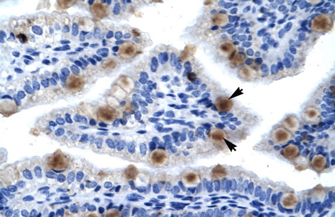 Antibody used in IHC on Human Lung.