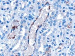 Immunohistochemistry-Paraffin: VPS25 Antibody [NB100-2468] - NB100-2468 (10ug/ml) staining of paraffin embedded Human Kidney. Microwaved antigen retrieval with Tris/EDTA buffer pH9, HRP-staining.