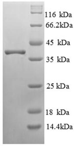 (Tris-Glycine gel) Discontinuous SDS-PAGE (reduced) with 5% enrichment gel and 15% separation gel.