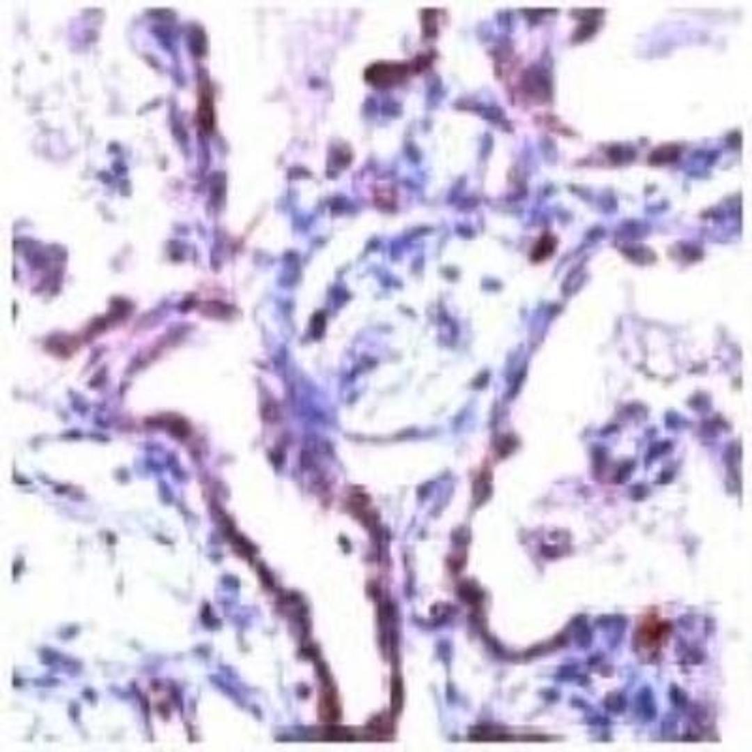 Immunohistochemistry: Claudin-5 Antibody [NB120-15106] - Man lung stained with Anti-Claudin 5 antibody, NB 120-15106