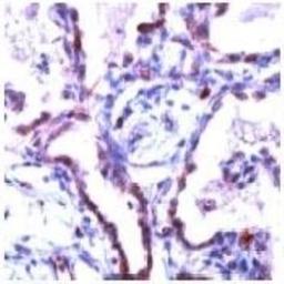 Immunohistochemistry: Claudin-5 Antibody [NB120-15106] - Man lung stained with Anti-Claudin 5 antibody, NB 120-15106