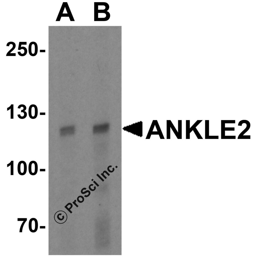 Western blot analysis of ANKLE2 in human testis tissue lysate with ANKLE2 antibody at (A) 1 and (B) 2 &#956;g/mL.