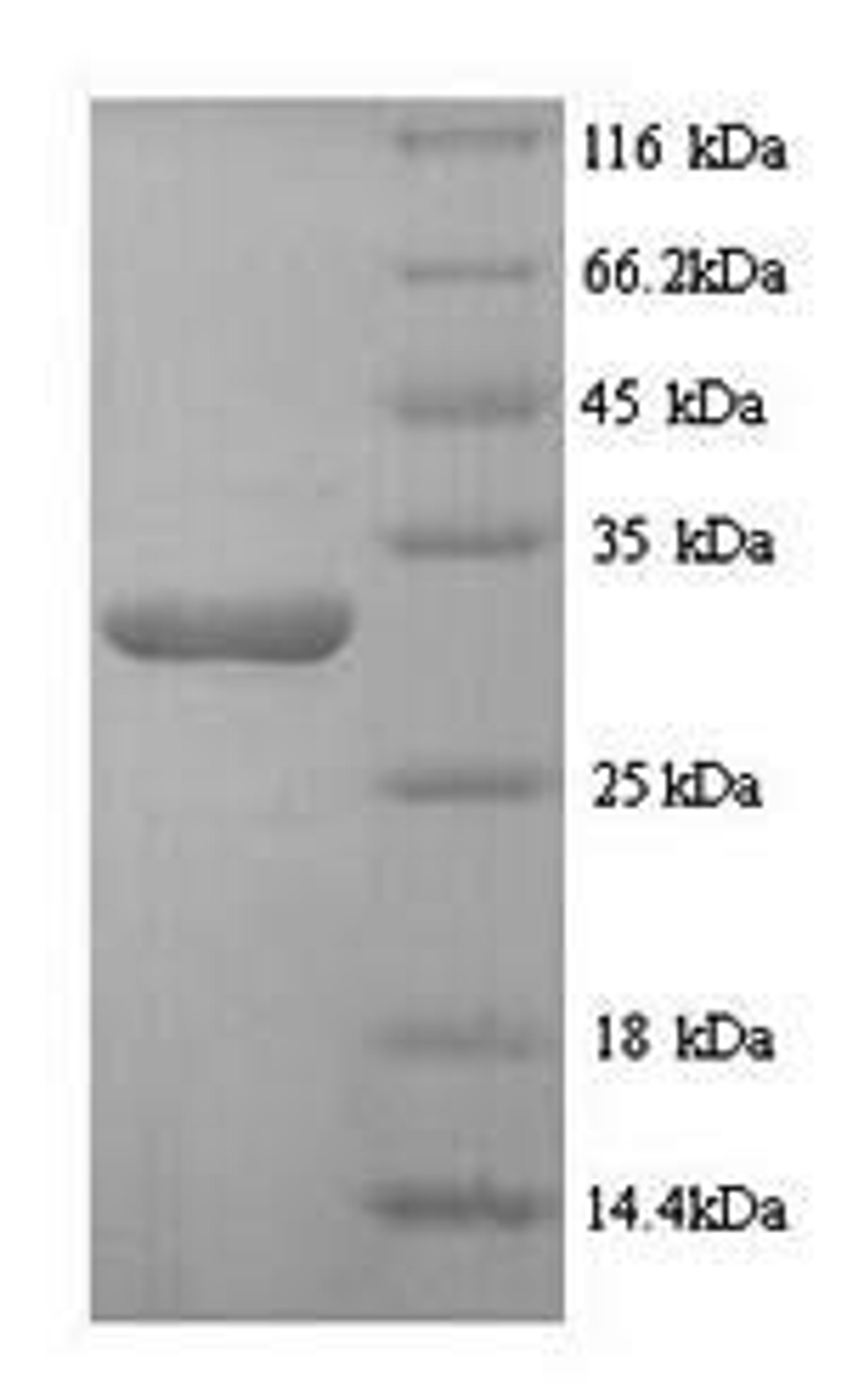 (Tris-Glycine gel) Discontinuous SDS-PAGE (reduced) with 5% enrichment gel and 15% separation gel.