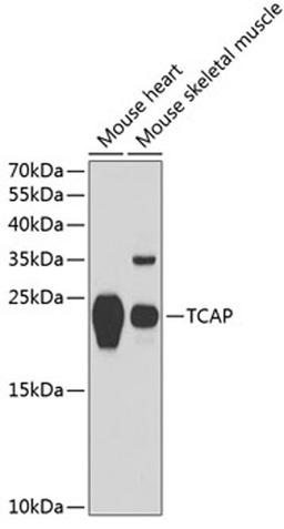 Western blot - TCAP antibody (A13566)